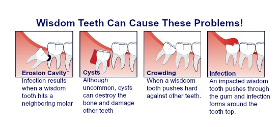 molar occurrences aftercare