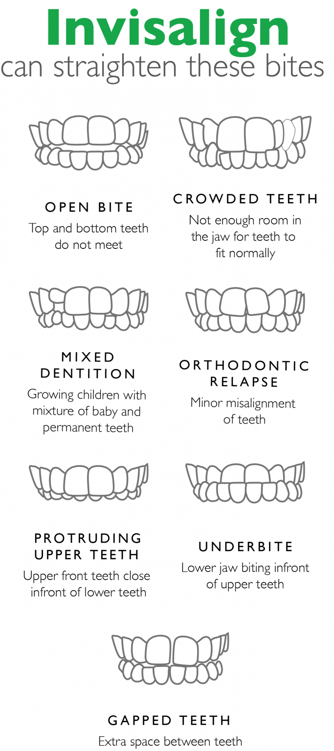 How Effective is Invisalign? | Greenlife Dental