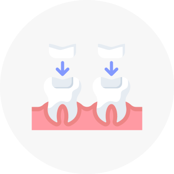 Fillings