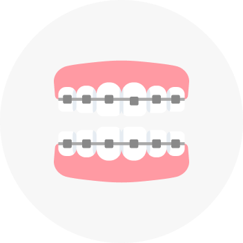 Invisalign