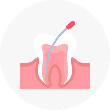 Root Canal